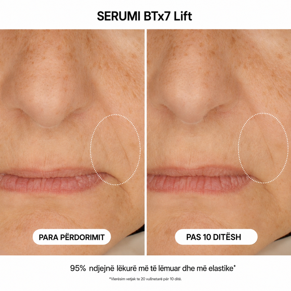 Serum BTx7 Lift me mikrospikula