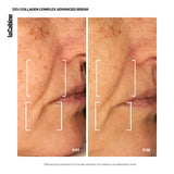 Serum Advanced 25% Collagen Complex dhe Retinal