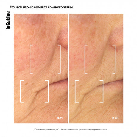 Serum Advanced 25% Hyaluronic Complex dhe Vitamine C