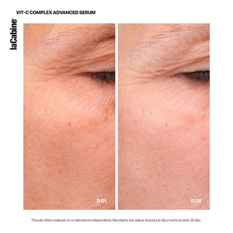 Serum Advanced 25% Vit-C Complex