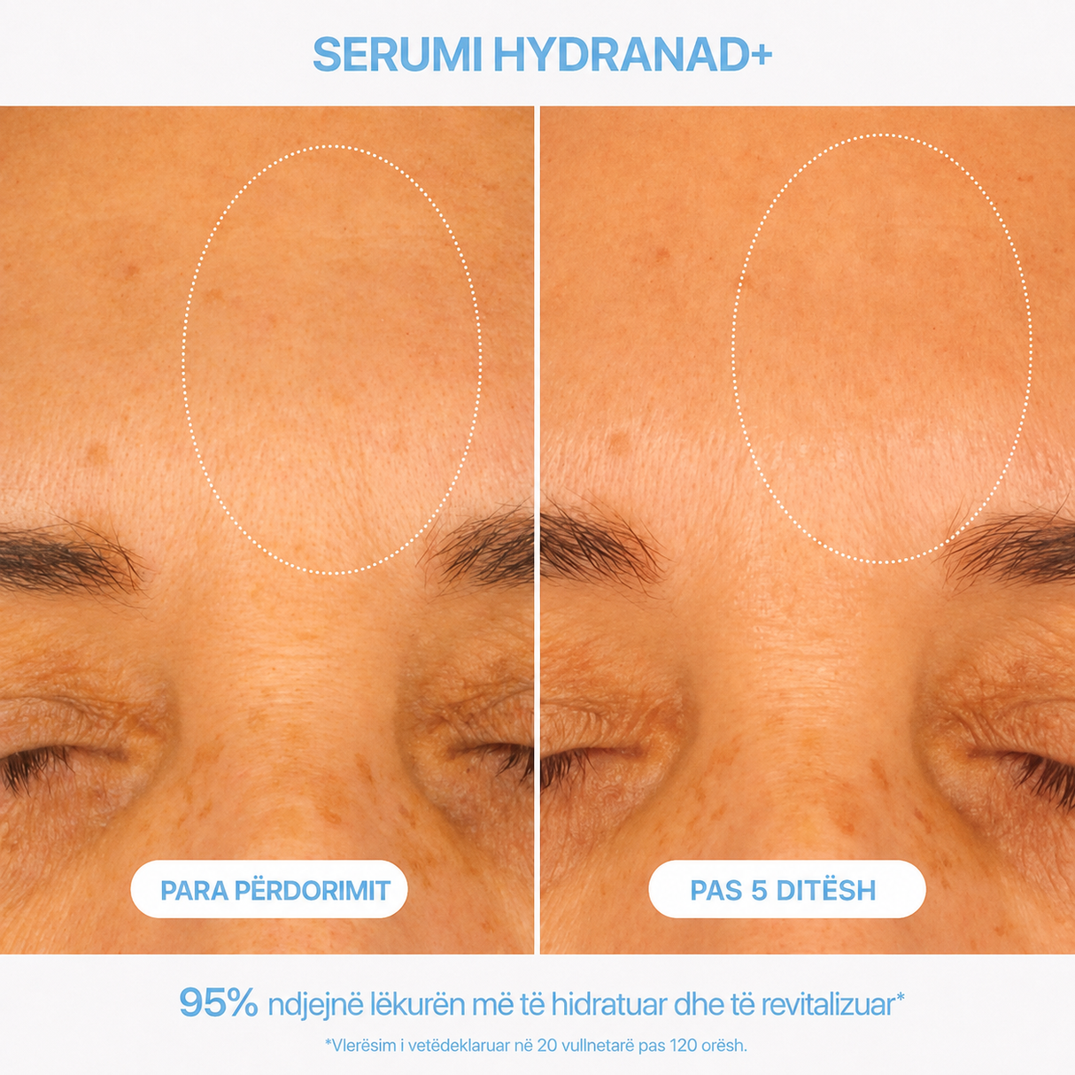 Serum HydraNAD+