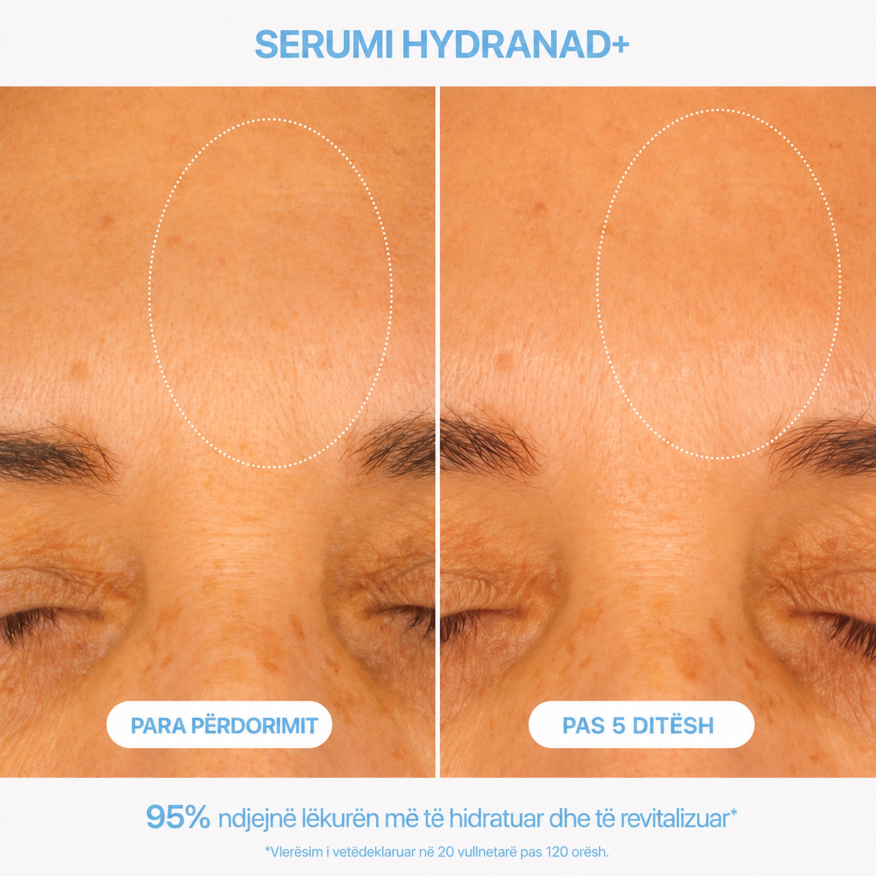Serum HydraNAD+
