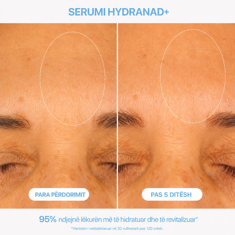 Serum HydraNAD+